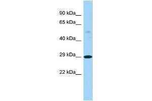 Host: Rabbit Target Name: PTCD3 Sample Type: RPMI-8226 Whole Cell lysates Antibody Dilution: 1. (PTCD3 Antikörper  (C-Term))