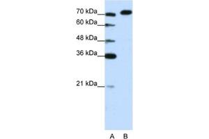 Western Blotting (WB) image for anti-A Kinase (PRKA) Anchor Protein 8-Like (AKAP8L) antibody (ABIN2461849)