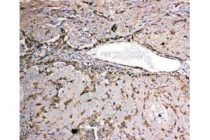 Immunohistochemistry (IHC) image for anti-Gelsolin (GSN) (AA 763-775) antibody (ABIN3031036)