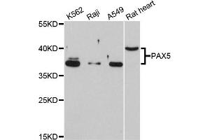 Western blot analysis of extracts of various cell lines, using PAX5 antibody. (PAX5 Antikörper)