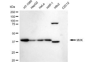 Western blotting analysis using MVK antibody (ABIN7799401). (Rekombinanter MVK Antikörper)