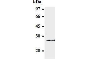 Western blot analysis of GST-SOCS-3 (2-44 a. (SOCS3 Antikörper  (AA 2-44))