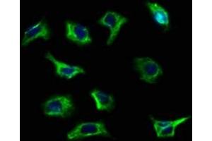 Immunofluorescence staining of A549 cells with ABIN7168513 at 1:100, counter-stained with DAPI. (RYR3 Antikörper  (AA 987-1147))