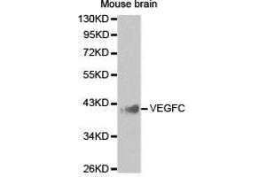 Western Blotting (WB) image for anti-Vascular Endothelial Growth Factor C (VEGFC) antibody (ABIN1875325) (VEGFC Antikörper)