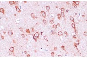 Immunohistochemistry of paraffin-embedded Rat brain using RPL21 Polyclonal Antibody at dilution of 1:100 (40x lens). (RPL21 Antikörper)