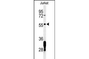 Western blot analysis of RNF8 Antibody (ABIN653777 and ABIN2843067) in Jurkat cell line lysates (35 μg/lane). (RNF8 Antikörper)