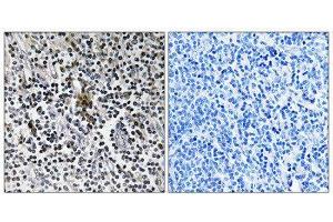 Immunohistochemistry (IHC) image for anti-Ribosomal Protein S3 (RPS3) (C-Term) antibody (ABIN1850588) (RPS3 Antikörper  (C-Term))