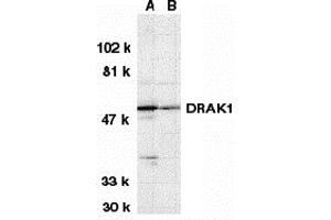 Western Blotting (WB) image for anti-serine/threonine Kinase 17a (STK17A) (N-Term) antibody (ABIN1031360) (STK17A Antikörper  (N-Term))