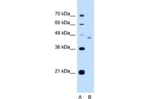 Western Blotting (WB) image for anti-FIC Domain Containing (FICD) antibody (ABIN2463017) (FICD Antikörper)
