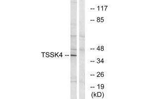 Western blot analysis of extracts from HT-29 cells, using TSSK4 antibody. (TSSK4 Antikörper  (Internal Region))