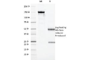 SDS-PAGE Analysis Purified HLA-DRA Monoclonal Antibody (19-26. (HLA-DRA Antikörper)