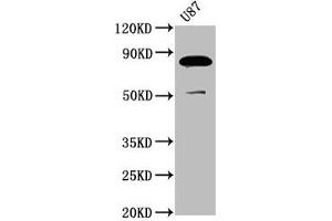 Western Blot Positive WB detected in: U87 whole cell lysate All lanes: FRMD7 antibody at 3. (FRMD7 Antikörper  (AA 464-617))