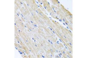 Immunohistochemistry of paraffin-embedded mouse heart using ABCB8 antibody (ABIN5974712) at dilution of 1/100 (40x lens). (ABCB8 Antikörper)