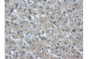 Immunohistochemical staining of paraffin-embedded liver tissue using anti-HDAC10mouse monoclonal antibody. (HDAC10 Antikörper)