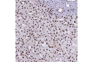 Immunohistochemical staining of human liver with SRRM2 polyclonal antibody  shows strong nuclear positivity in hepatocytes.