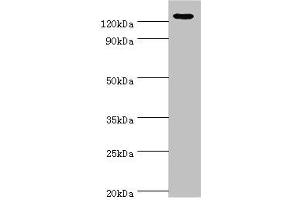 Western blot All lanes: NLRP2 antibody at 12 μg/mL + A431 whole cell lysate Secondary Goat polyclonal to rabbit IgG at 1/10000 dilution Predicted band size: 121, 119, 97, 118 kDa Observed band size: 121 kDa (NLRP2 Antikörper  (AA 1-220))
