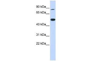 WB Suggested Anti-TRMT1 Antibody Titration:  0. (TRMT1 Antikörper  (N-Term))