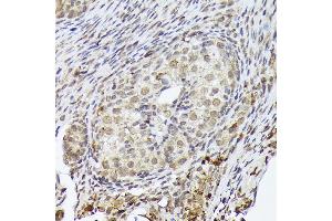 Immunohistochemistry of paraffin-embedded rat ovary using PSMD14 Rabbit mAb (ABIN7269588) at dilution of 1:100 (40x lens). (PSMD14 Antikörper)