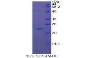 SDS-PAGE (SDS) image for Retinol Binding Protein 4, Plasma (RBP4) (AA 1-183) protein (His tag) (ABIN1080650) (RBP4 Protein (AA 1-183) (His tag))