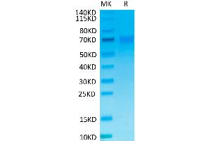 Human NKp46 on Tris-Bis PAGE under reduced condition. (NCR1 Protein (mFc Tag))