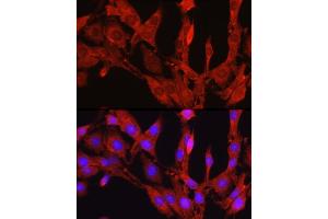 Immunofluorescence analysis of PC-12 cells using Proprotein Convertase 9(PCSK9) Rabbit pAb (ABIN6133851, ABIN6145328, ABIN6145330 and ABIN6223837) at dilution of 1:250 (40x lens). (PCSK9 Antikörper  (C-Term))