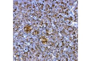IHC analysis of PD1/Pdcd1 using anti-PD1/Pdcd1 antibody (ABIN7601831).