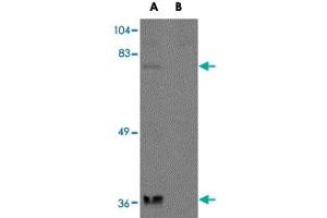 Western blot analysis of NAA35 in rat heart tissue lysate with NAA35 polyclonal antibody  at 1 ug/mL in the (A) absence and (B) presence of blocking peptide. (MAK10/NAA35 Antikörper  (N-Term))