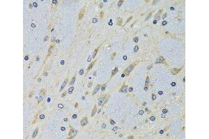 Immunohistochemistry of paraffin-embedded Mouse brain using DARS Polyclonal Antibody at dilution of 1:100 (40x lens). (DARS Antikörper)