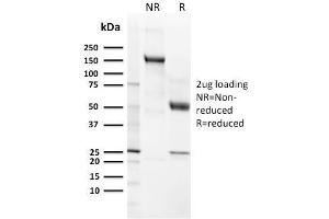 SDS-PAGE (SDS) image for anti-Complement Component (3d/Epstein Barr Virus) Receptor 2 (CR2) (AA 142-240) antibody (ABIN6939186)
