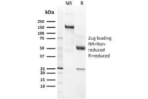 SDS-PAGE Analysis Purified CD21 / CR2 Recombinant Rabbit Monoclonal Antibody (CR2/3124R). (Rekombinanter CD21 Antikörper  (AA 142-240))