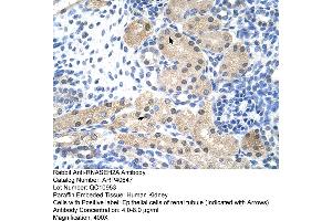 Rabbit Anti-RNASEH2A Antibody  Paraffin Embedded Tissue: Human Kidney Cellular Data: Epithelial cells of renal tubule Antibody Concentration: 4. (RNASEH2A Antikörper  (Middle Region))