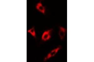 Immunofluorescent analysis of MsrA staining in U2OS cells.