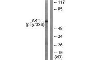 Western blot analysis of extracts from mouse liver, using Akt (Phospho-Tyr326) Antibody. (AKT1 Antikörper  (pTyr326))