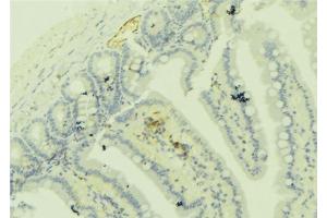 ABIN6279274 at 1/100 staining Mouse colon tissue by IHC-P. (Centriolin Antikörper)