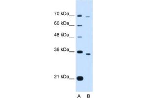 Western Blotting (WB) image for anti-PHD Finger Protein 6 (PHF6) antibody (ABIN2463418) (PHF6 Antikörper)
