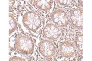 Immunohistochemistry of TEM1 in human colon tissue with this product at 2. (CD248 Antikörper  (N-Term))