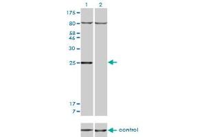 Western blot analysis of HOXB7 over-expressed 293 cell line, cotransfected with HOXB7 Validated Chimera RNAi (Lane 2) or non-transfected control (Lane 1). (HOXB7 Antikörper  (AA 55-120))