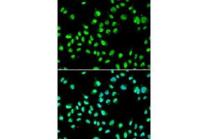 Immunofluorescence analysis of A549 cells using GTF2F2 antibody. (GTF2F2 Antikörper  (AA 1-249))