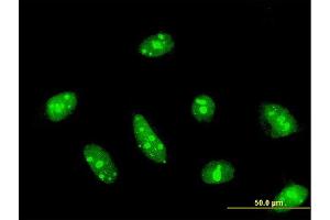 Immunofluorescence of monoclonal antibody to CDC14A on HeLa cell. (CDC14A Antikörper  (AA 431-530))