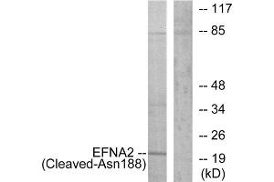 Western blot analysis of extracts from 293 cells, treated with etoposide (25uM, 1hour), using EFNA2 (Cleaved-Asn188) antibody. (Ephrin A2 Antikörper  (Cleaved-Asn188))