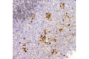 IHC analysis of Cyclophilin B using anti-Cyclophilin B antibody (ABIN6719475). (PPIB Antikörper  (AA 158-216))