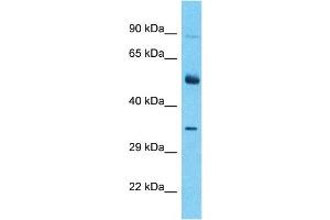 Host:  Rabbit  Target Name:  ALX3  Sample Type:  Thymus Tumor lysates  Antibody Dilution:  1. (ALX3 Antikörper  (C-Term))