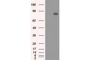 Western Blotting (WB) image for anti-SATB Homeobox 1 (SATB1) antibody (ABIN1500810) (SATB1 Antikörper)