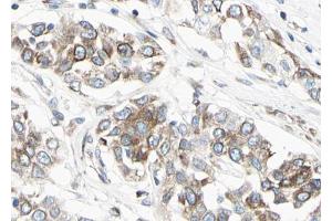 ABIN6267044 at 1/100 staining human Lung tissue sections by IHC-P. (NF-kB p65 Antikörper  (C-Term))