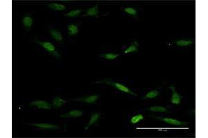 Immunofluorescence of purified MaxPab antibody to NFAT5 on HeLa cell. (NFAT5 Antikörper  (AA 1-1484))