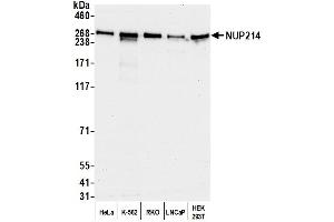 anti-Nucleoporin 214kDa (NUP214) (AA 1250-1300) antibody
