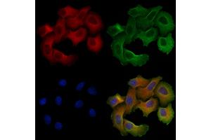 ABIN6257099 and ABIN6275623 staining Hela cells by IF/ICC. (CCT5 Antikörper  (Internal Region))