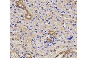 Immunohistochemistry of paraffin-embedded Rat kidney using TNFRSF1B Polyclonal Antibody at dilution of 1:200 (40x lens).