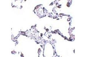 Immunohistochemistry (IHC) image for anti-CD81 (CD81) (N-Term) antibody (ABIN1031309) (CD81 Antikörper  (N-Term))