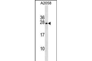 CHCHD6 Antibody (Center) (ABIN1537835 and ABIN2849408) western blot analysis in  cell line lysates (35 μg/lane). (CHCHD6 Antikörper  (AA 136-165))